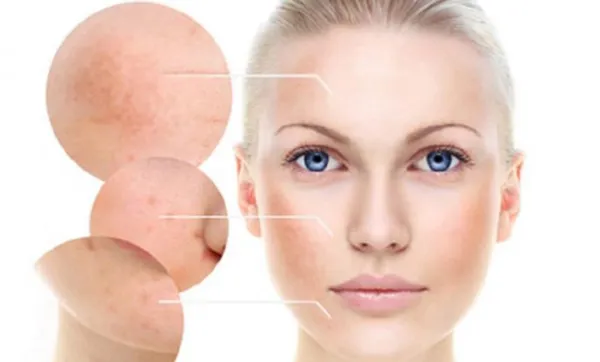 Top 7 đồ uống trị nám từ bên trong hiệu quả hiện nay