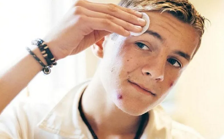 sản phẩm hỗ trợ làm sạch mụn cho nam 4