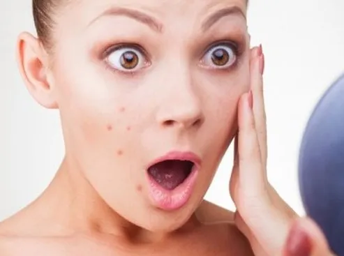 Review 15 kem trị thâm mụn lâu năm hiệu quả tốc độ vượt trội tại nhà
