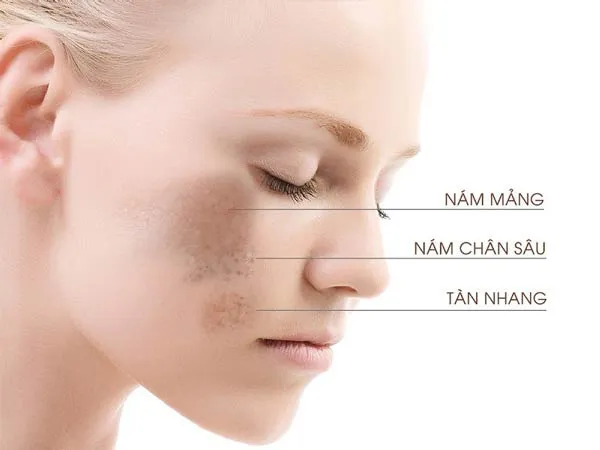 Review 10 kem dưỡng làm mờ nám da tàn nhang Hàn Quốc được nhiều khách hàng yêu thích nên dùng