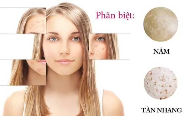 Top 9 kem dưỡng làm mờ nám tàn nhang của Nhật chất lượng tốt 2025