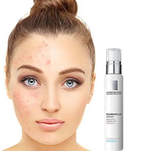Top 15 serum trị thâm mụn được đánh giá được nhiều khách hàng yêu thích hiện nay 11