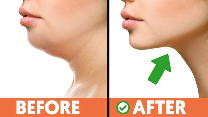 10 bài tập giảm mỡ nọng cằm nhanh chóng trong 1 tháng