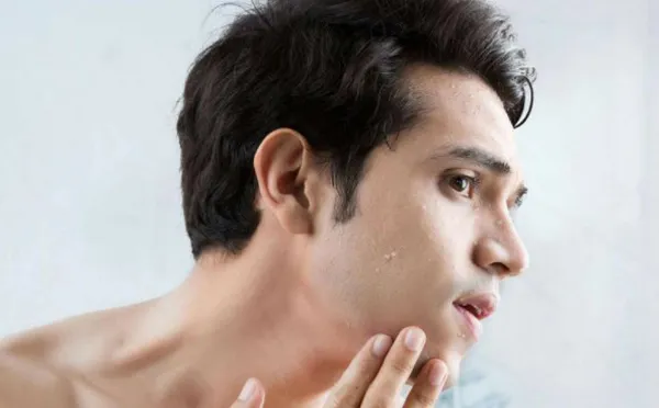 10 cách chăm sóc da mặt cho nam đơn giản ai cũng làm được