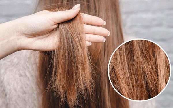 Top 10 dầu gội đầu cho tóc khô xơ dưỡng mềm mượt chất lượng tốt