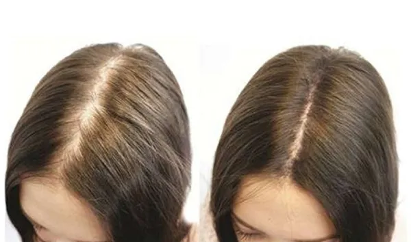 8 mẹo dưỡng tóc bằng dầu dừa giúp tóc dài nhanh và suôn mượt
