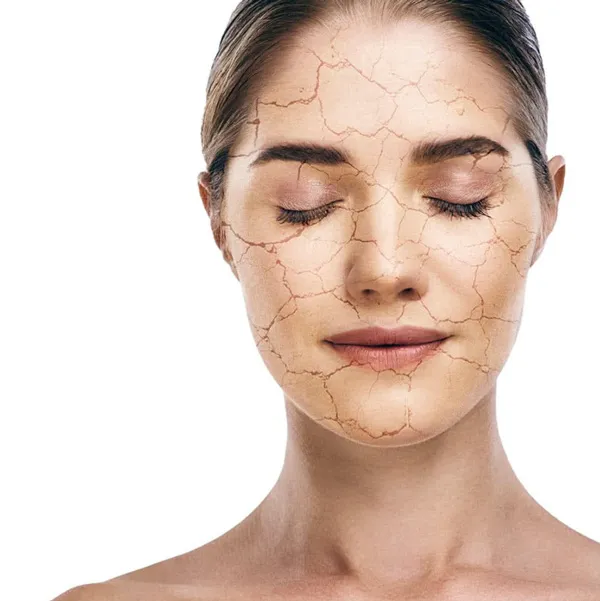 Mách bạn quy trình 8 bước skincare mùa đông hanh khô bạn phải biết 1