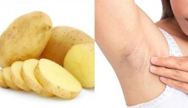 Top 11 cách triệt lông nách vĩnh viễn tại nhà cho nữ đơn giản - 4