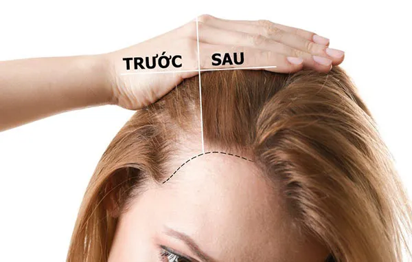 14 cách kích thích tóc mọc dài nhanh trong 1 tuần tại nhà