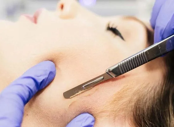 10 cách tẩy sạch lông mặt hiệu quả nhanh và không đau - 9