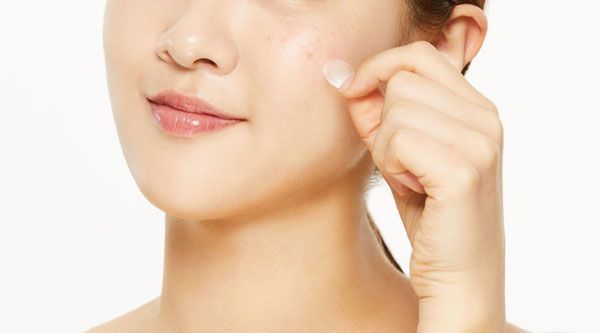 Top 13+ miếng dán hỗ trợ làm sạch mụn chất lượng tốt cho da sạch mụn mịn màng