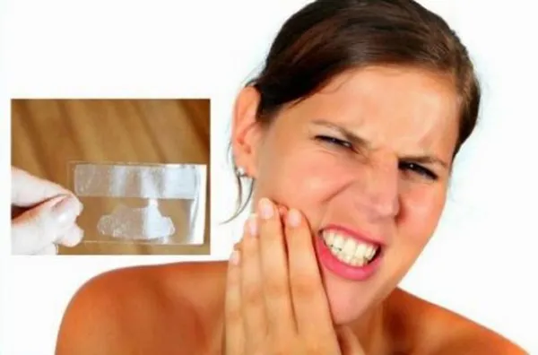 Miếng dán trắng răng có tốt không? Top 5 miếng dán trắng răng bán chạy