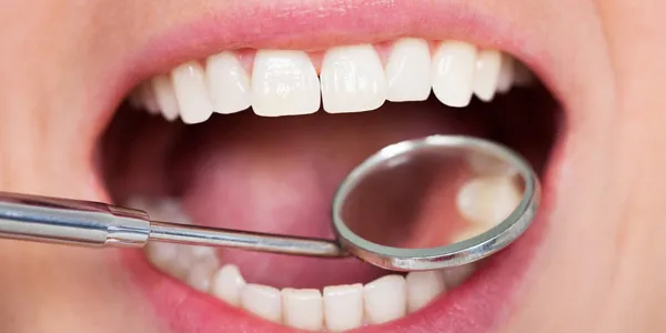 Miếng dán trắng răng có tốt không? Top 5 miếng dán trắng răng bán chạy