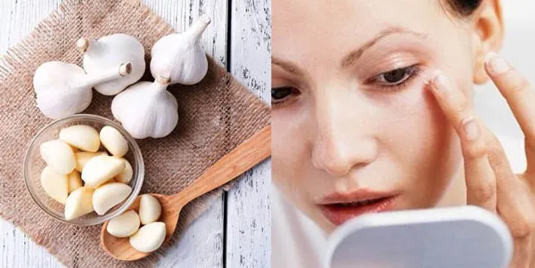 Hướng dẫn 6 cách hỗ trợ làm sạch mụn thịt quanh mắt giúp cải thiện đáng kể điểm tại nhà 8