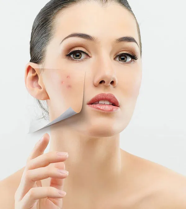 Review chi tiết 10 sản phẩm skincare cho da khô mụn nổi trội định phải biết