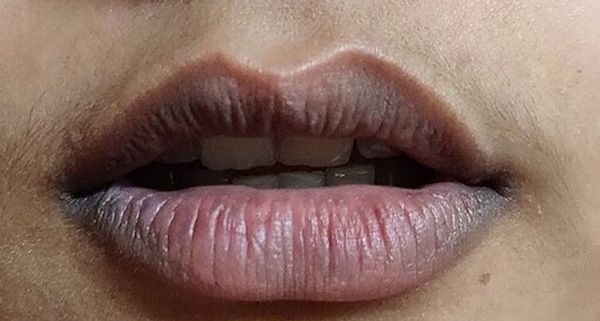 Cách chọn son dưỡng môi chống nắng giúp môi hết thâm luôn hồng