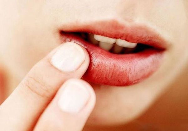 Cách chọn son dưỡng môi chống nắng giúp môi hết thâm luôn hồng