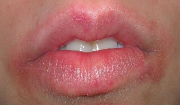 Cách chọn son dưỡng môi chống nắng giúp môi hết thâm luôn hồng