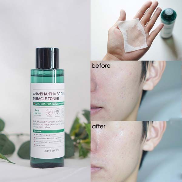 Review 10 toner AHA/BHA được nhiều khách hàng yêu thích để da sạch mụn ẩn, căng bóng