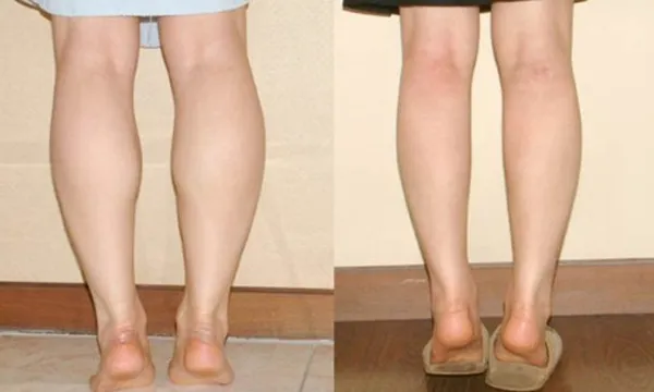 Top 13 bài tập thon gọn chân tốc độ vượt trội cho nữ tại nhà