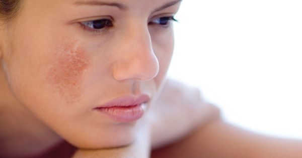 5 ngày phục hồi chăm sóc da sau Tết tươi tắn, rạng rỡ - 4