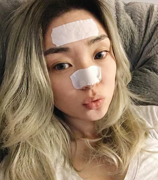 12 Miếng dán lột mụn đầu đen se khít lỗ chân lông ở mũi chất lượng tốt
