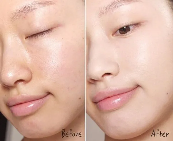 Peel da là gì có tốt không? Chăm sóc da sau peel hiệu quả