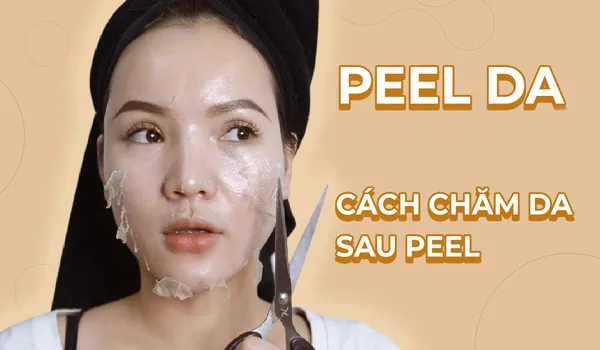 Peel da là gì có tốt không? Chăm sóc da sau peel hiệu quả