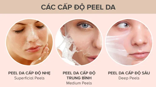Peel da là gì có tốt không? Chăm sóc da sau peel hiệu quả