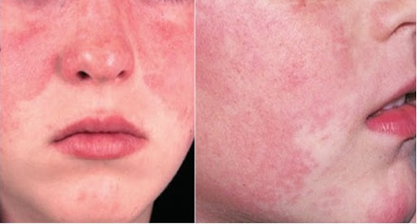 Điều gì xảy ra khi bạn rửa mặt sai cách? Hướng dẫn chọn sữa rửa mặt phù hợp - 5