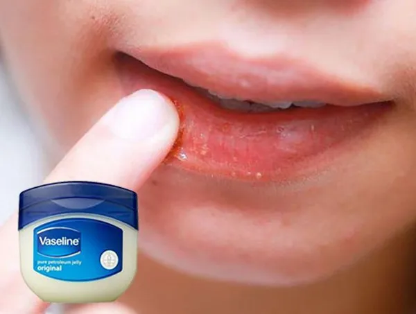 9+ tips làm môi mỏng hình trái tim tại nhà rất đơn giản