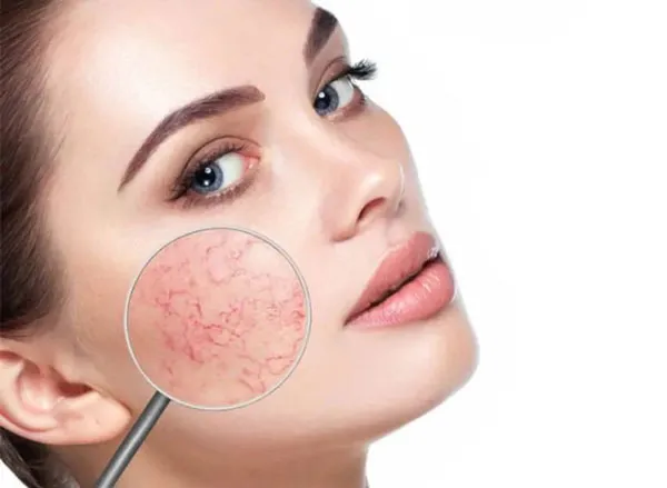 Top 13 mỹ phẩm cho da mỏng giúp phục hồi và bảo vệ hiệu quả