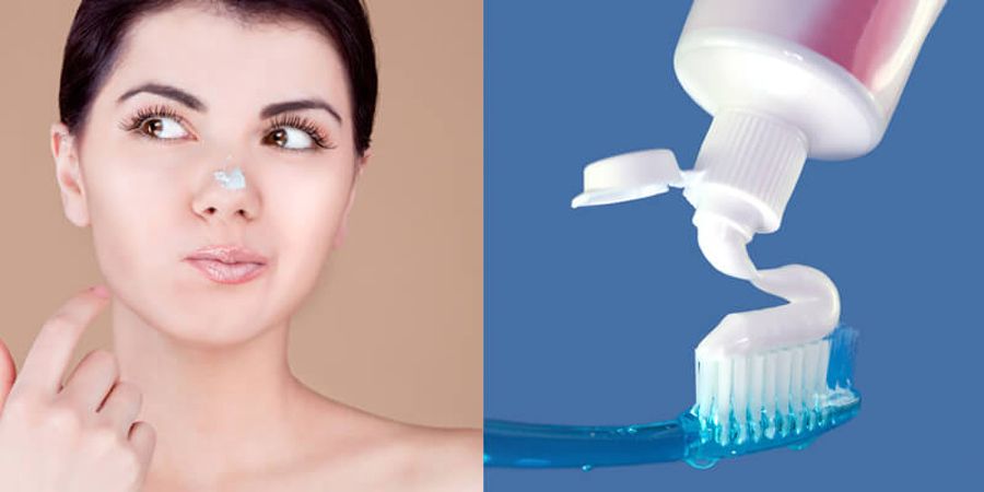 12 cách hỗ trợ làm sạch mụn đỏ, giảm mụn sưng đỏ nhanh chóng cấp tốc