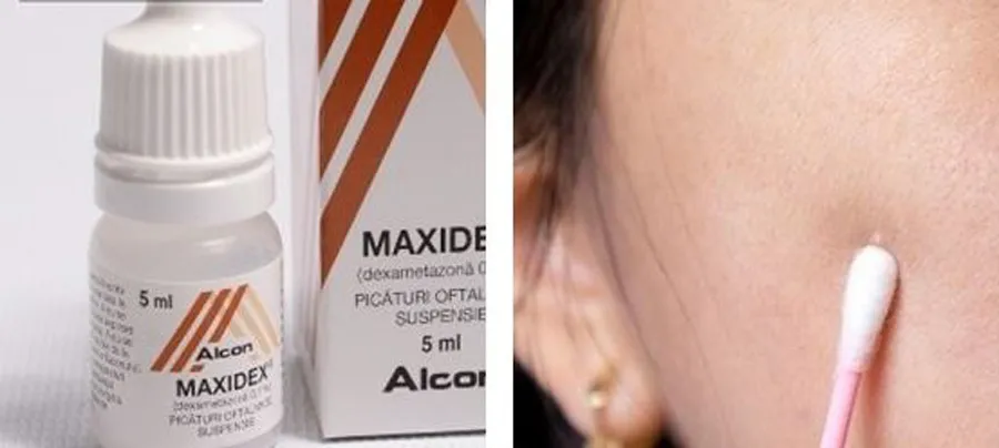12 cách hỗ trợ làm sạch mụn đỏ, giảm mụn sưng đỏ nhanh chóng cấp tốc