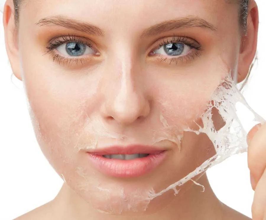 12 cách làm mờ sẹo thủy đậu thân thiện với làn da và rất nhanh chóng
