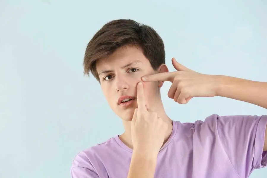 Chế độ ăn uống cho da bị mụn: Nên ăn gì và không ăn gì? - 2