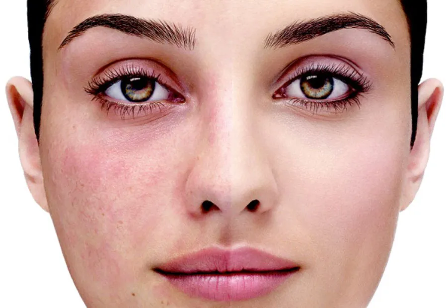 Top 10 kem dưỡng cho da giãn mao mạch chuyên gia đánh giá tốt 19