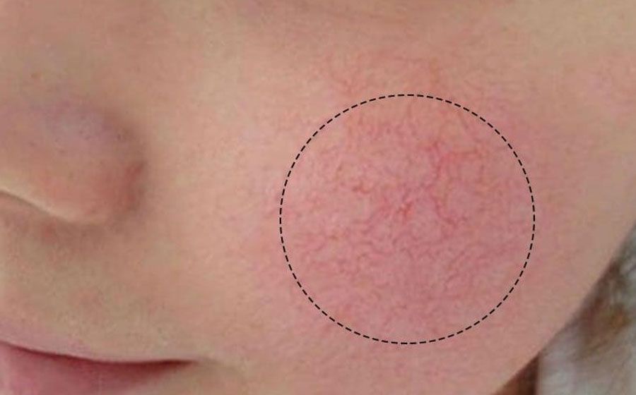 Top 10 kem dưỡng cho da giãn mao mạch chuyên gia đánh giá tốt 21