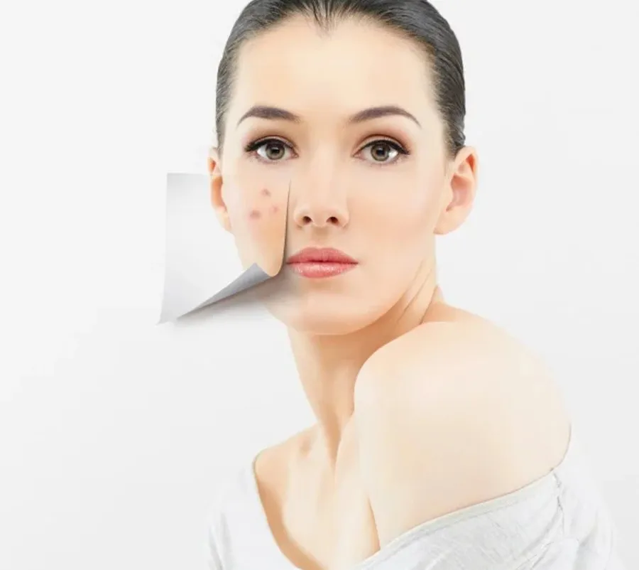 Top 10 kem dưỡng cho da giãn mao mạch chuyên gia đánh giá tốt 3