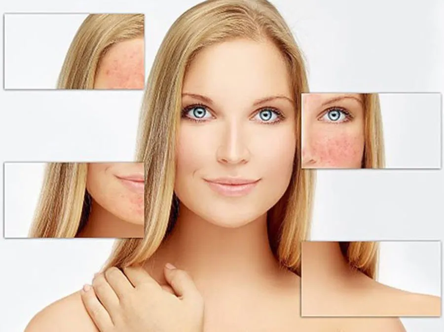 Top 10 kem dưỡng cho da giãn mao mạch chuyên gia đánh giá tốt 4