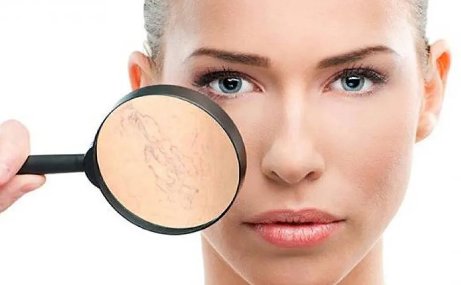 Top 10 kem dưỡng cho da giãn mao mạch chuyên gia đánh giá tốt 5