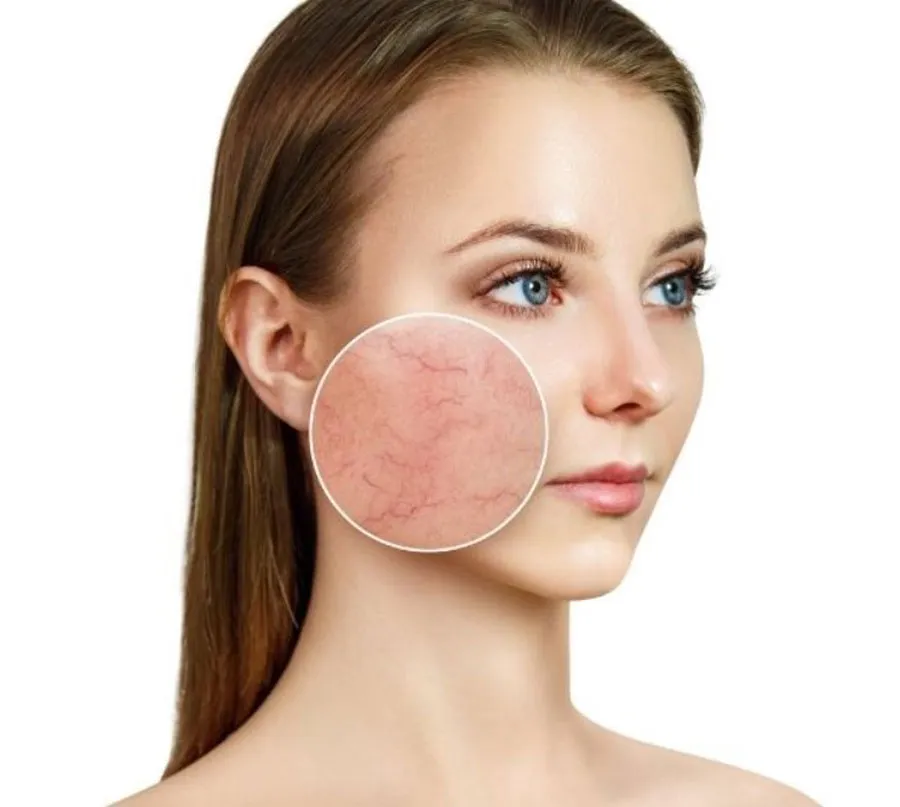 Top 10 kem dưỡng cho da giãn mao mạch chuyên gia đánh giá tốt 6