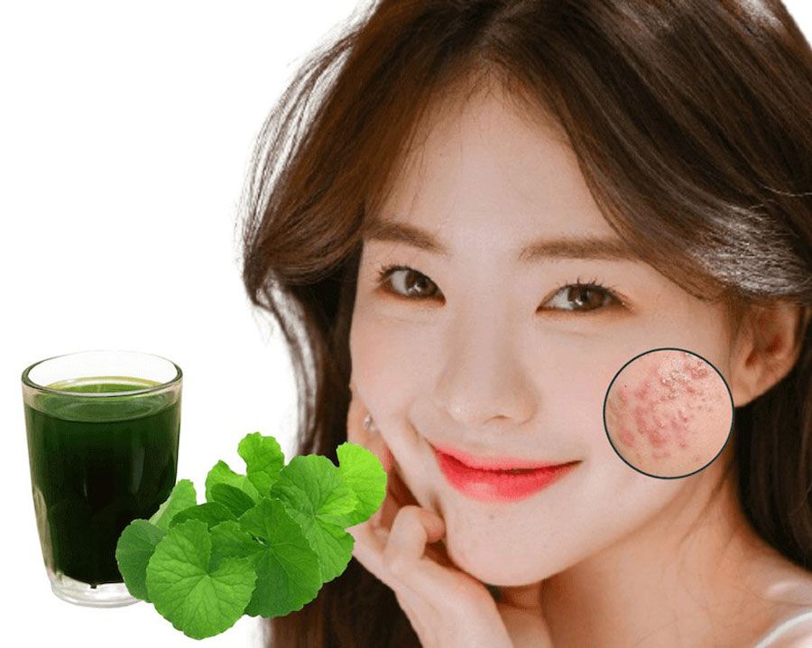 Top 8 mỹ phẩm chiết xuất từ Centella Asiatica được nhiều khách hàng yêu thích cho da - 5