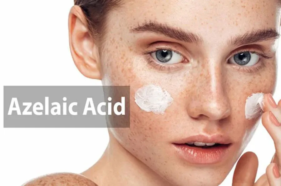 Top 6 mỹ phẩm chứa Azelaic Acid hỗ trợ làm sạch mụn mờ thâm nên dùng 1