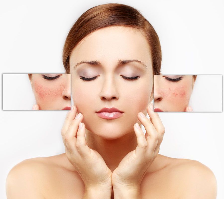 4 bước rửa mặt bằng sữa tươi không đường cho da trắng mịn miễn chê - 7