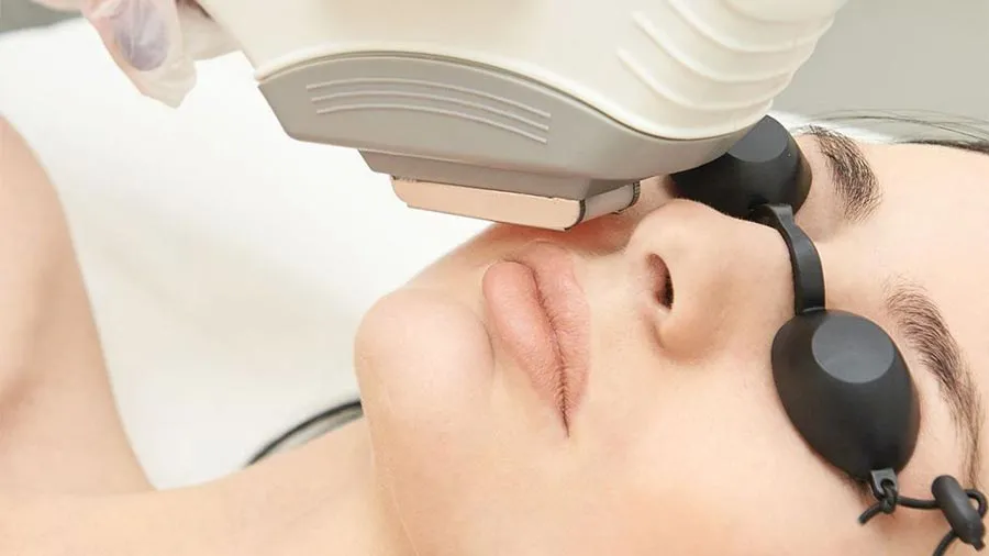 Gợi ý 10 cách tẩy sạch ria mép thân thiện với làn da cho nữ tại nhà