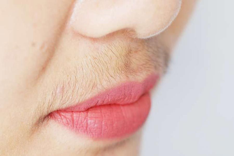 Gợi ý 10 cách tẩy sạch ria mép thân thiện với làn da cho nữ tại nhà