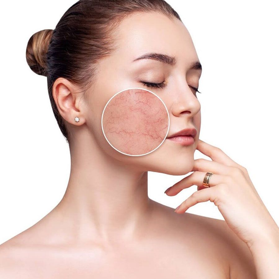 Review 10 nước hoa hồng cho da nhạy cảm giá bình dân - 1