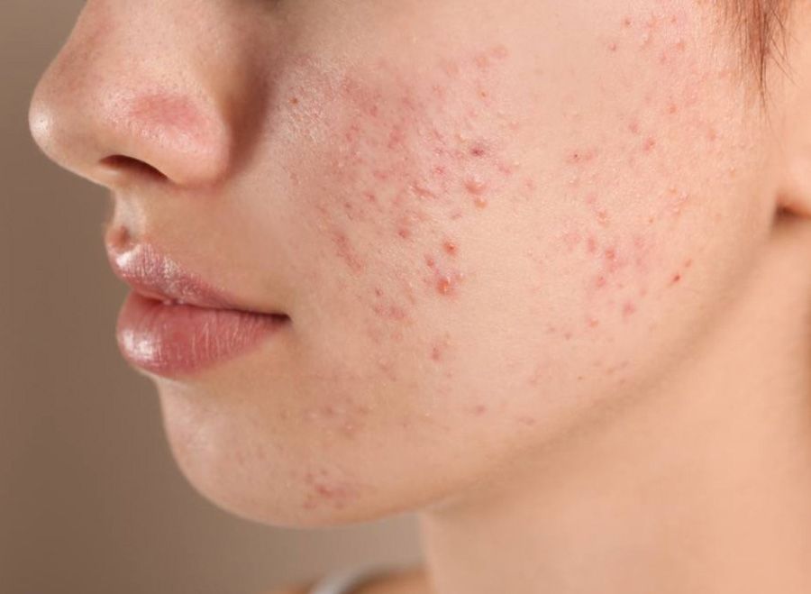 Purging là gì? Tổng hợp những việc cần làm trong quá trình Purging