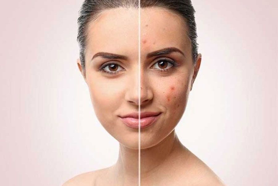 Purging là gì? Tổng hợp những việc cần làm trong quá trình Purging